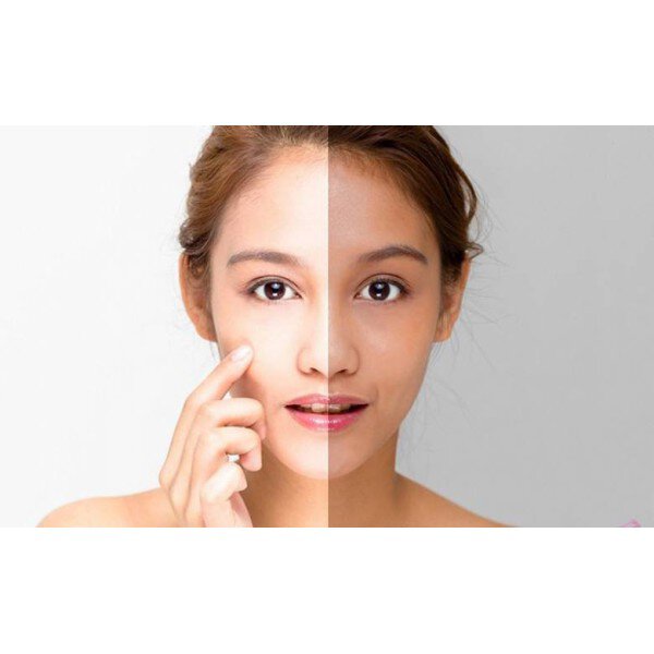 Làm đẹp bằng cách bổ sung nội tiết tố nữ